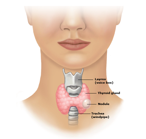 thyroid2