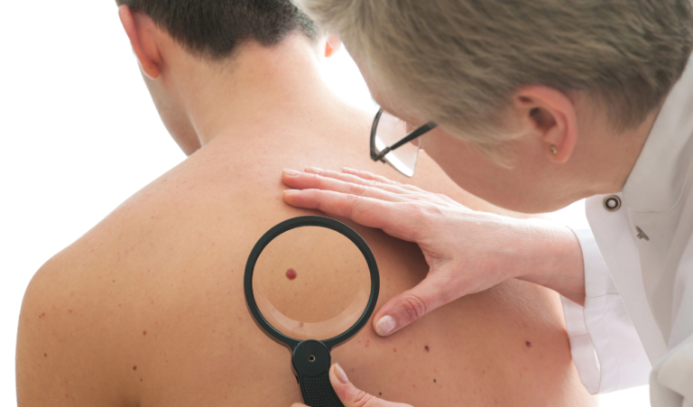 Dermatologists in Preventing Skin Cancer